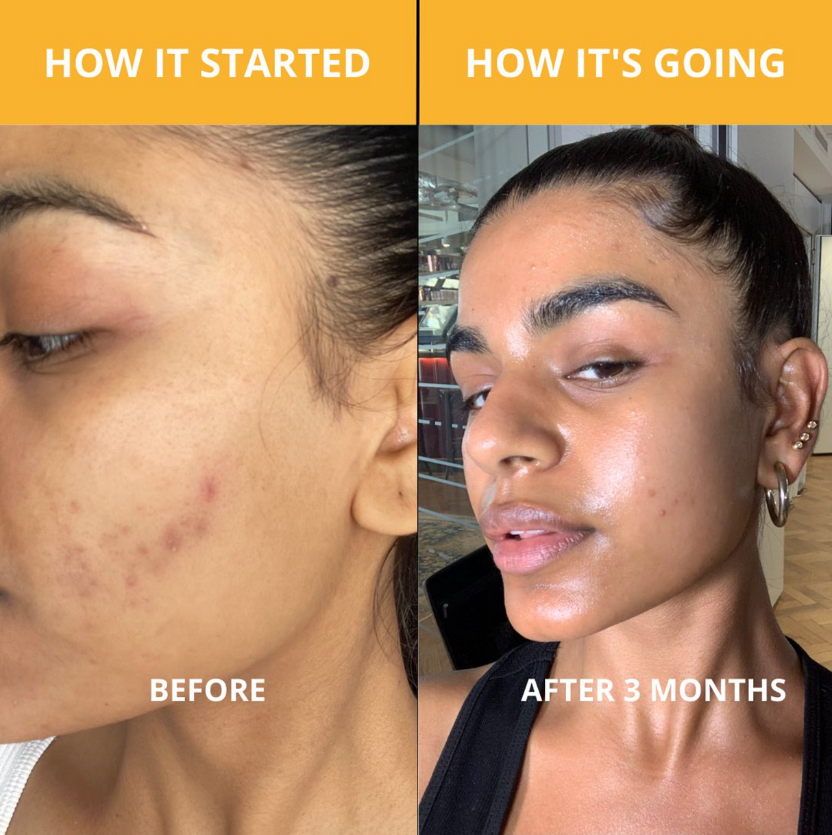 Glow Skincare Bundle - HoneyBug